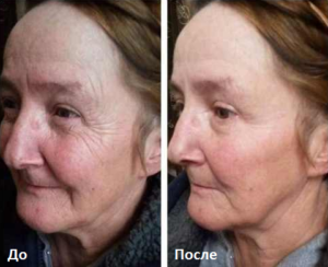 instantly_ageless_before_and_after-1