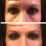 Результат применения крема Instantly Ageless --- instantly_ageless_before_and_after-1