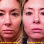 Результат применения микро-крема Instantly Ageless компании Jeunesse Global --- instantly_ageless_before_and_after