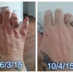 Luminesce serum by Jeunesse (before-and-after pictures) for hands