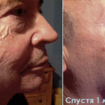 Luminesce cosmetics by Jeunesseglobal (before-and-after)