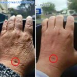 Luminesce serum by Jeunesse (before-and-after pictures) for hands