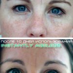 Крем Instantly Ageless - фото клиентов до и после