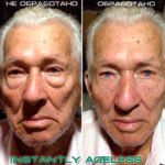 Крем Instantly Ageless - фото клиентов до и после