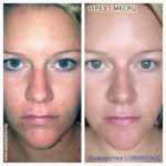 Luminesce Rejuvenation сыворотка от Jeunesse (фото до и после)