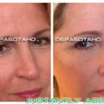 Крем Instantly Ageless - фото клиентов до и после