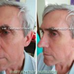 Крем Instantly Ageless - фото клиентов до и после