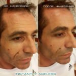 Крем Instantly Ageless - фото клиентов до и после