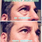 Крем Instantly Ageless - фото клиентов до и после