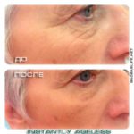 Крем Instantly Ageless - фото клиентов до и после