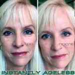 Крем Instantly Ageless - фото клиентов до и после