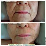 Крем Instantly Ageless - фото пожилой клиентки до и после