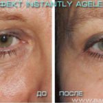 Крем Instantly Ageless - фото реальной клиентки до и после